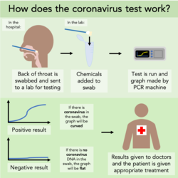 Coronavirus testing1