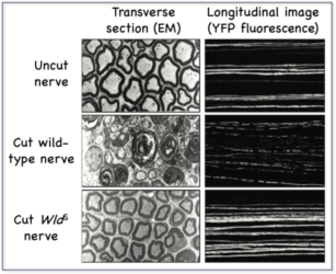 NRN image